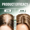Ball-shaped hair growth essence